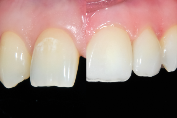 Charlestown Dental Website Homepage (5)